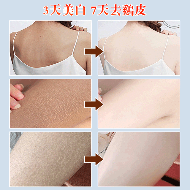 凡士林去雞皮煥亮身體乳，一瓶改善粗糙肌膚！滋潤嫩白，煥發肌膚青春態，全身滋養，持久留香，肌膚嫩滑香甜，更迷人，閃耀每一刻！
